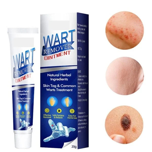 Warts Remover Cream